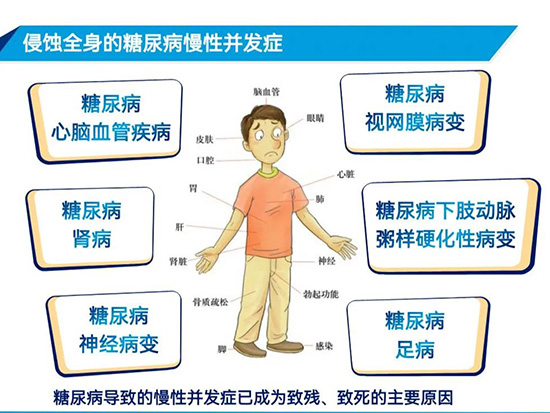 帶您了解糖尿病的慢性并發(fā)癥